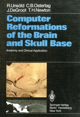 Unsöld / Newton / Ostertag |  Computer Reformations of the Brain and Skull Base | Buch |  Sack Fachmedien