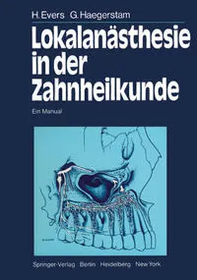 Evers / Haegerstam / Hakansson |  Lokalanästhesie in der Zahnheilkunde | eBook | Sack Fachmedien