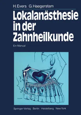 Evers / Haegerstam / Hakansson |  Lokalanästhesie in der Zahnheilkunde | Buch |  Sack Fachmedien