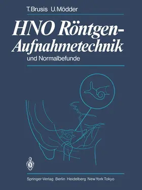 Mödder / Brusis |  HNO Röntgen-Aufnahmetechnik und Normalbefunde | Buch |  Sack Fachmedien