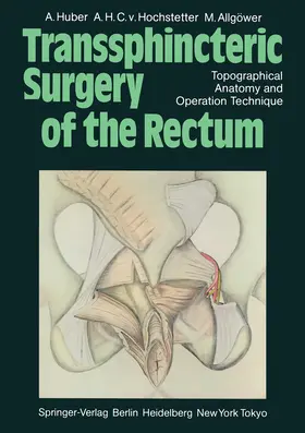 Huber / Allgöwer / Hochstetter |  Transsphincteric Surgery of the Rectum | Buch |  Sack Fachmedien