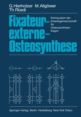 Hierholzer / Rüedi / Allgöwer |  Fixateur-externe-Osteosynthese | Buch |  Sack Fachmedien