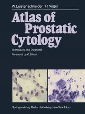 Leistenschneider / Nagel |  Atlas of Prostatic Cytology | eBook | Sack Fachmedien