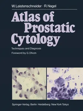 Leistenschneider / Nagel |  Atlas of Prostatic Cytology | Buch |  Sack Fachmedien