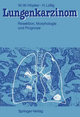 Höpker / Lüllig |  Lungenkarzinom | Buch |  Sack Fachmedien