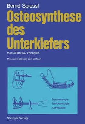 Spiessl |  Osteosynthese des Unterkiefers | eBook | Sack Fachmedien