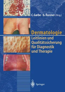 Rassner / Garbe |  Dermatologie | Buch |  Sack Fachmedien