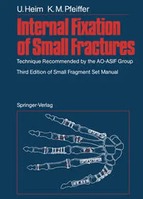 Heim / Pfeiffer |  Internal Fixation of Small Fractures | eBook | Sack Fachmedien
