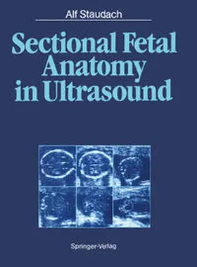 Staudach |  Sectional Fetal Anatomy in Ultrasound | eBook | Sack Fachmedien