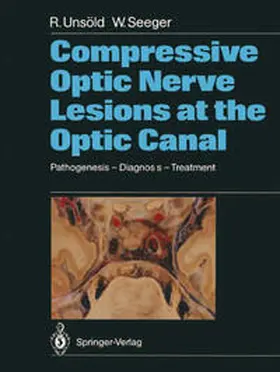Unsöld / Seeger |  Compressive Optic Nerve Lesions at the Optic Canal | eBook | Sack Fachmedien