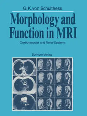 Schulthess |  Morphology and Function in MRI | eBook | Sack Fachmedien