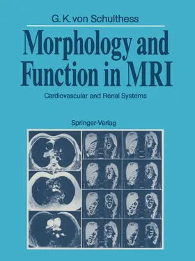 Schulthess |  Morphology and Function in MRI | Buch |  Sack Fachmedien