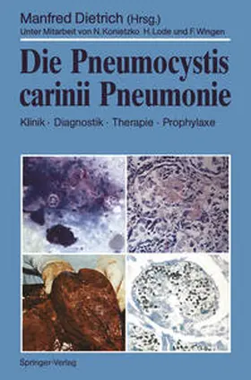 Dietrich |  Die Pneumocystis carinii Pneumonie | eBook | Sack Fachmedien