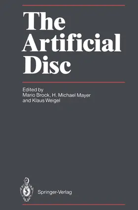 Brock / Mayer / Weigel |  The Artificial Disc | Buch |  Sack Fachmedien