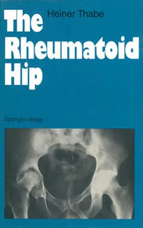 Thabe |  The Rheumatoid Hip | eBook | Sack Fachmedien