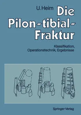 Heim |  Die Pilon-tibial-Fraktur | eBook | Sack Fachmedien