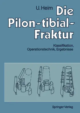 Heim |  Die Pilon-tibial-Fraktur | Buch |  Sack Fachmedien