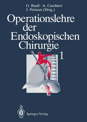 Bueß / Perissat / Cuschieri |  Operationslehre der Endoskopischen Chirurgie 1 | Buch |  Sack Fachmedien