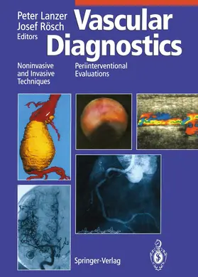 Rösch / Lanzer |  Vascular Diagnostics | Buch |  Sack Fachmedien
