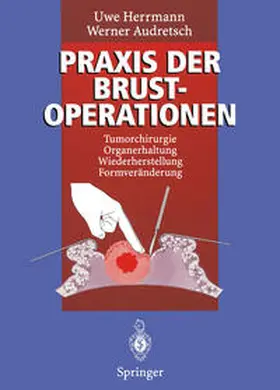 Herrmann / Audretsch |  Praxis der Brustoperationen | eBook | Sack Fachmedien
