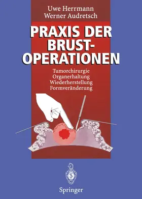 Audretsch / Herrmann |  Praxis der Brustoperationen | Buch |  Sack Fachmedien