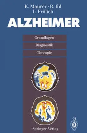 Maurer / Ihl / Frölich |  Alzheimer | eBook | Sack Fachmedien