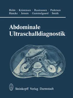 Holm / Kristensen / Rasmussen |  Abdominale Ultraschalldiagnostik | eBook | Sack Fachmedien