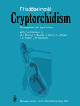 Hadziselimovic |  Cryptorchidism | eBook | Sack Fachmedien
