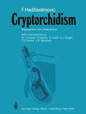 Hadziselimovic |  Cryptorchidism | Buch |  Sack Fachmedien