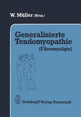 Müller |  Generalisierte Tendomyopathie (Fibromyalgie) | Buch |  Sack Fachmedien
