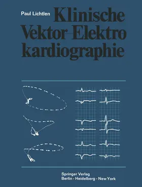 Lichtlen |  Klinische Vektor-Elektrokardiographie | Buch |  Sack Fachmedien