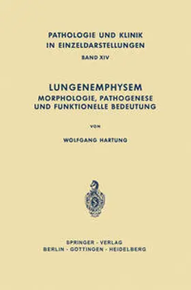 Hartung |  Lungenemphysem | eBook | Sack Fachmedien
