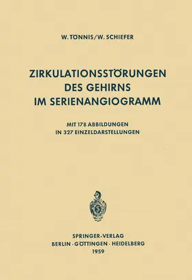 Schiefer / Tönnis |  Zirkulationsstörungen des Gehirns im Serienangiogramm | Buch |  Sack Fachmedien