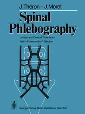 Theron / Moret |  Spinal Phlebography | eBook | Sack Fachmedien