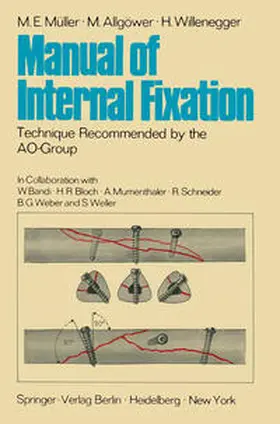 Müller / Allgöwer / Willenegger |  Manual of Internal Fixation | eBook | Sack Fachmedien
