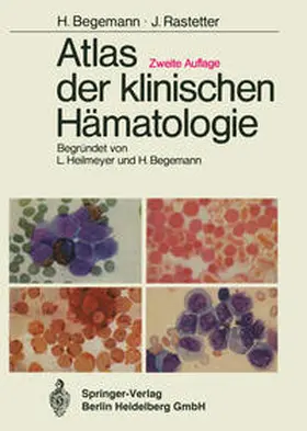 Heilmeyer / Begemann / Haferlach |  Atlas der klinischen Hämatologie | eBook | Sack Fachmedien