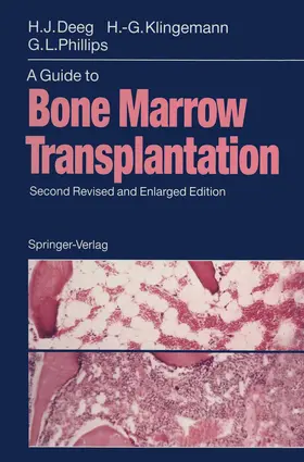 Deeg / Phillips / Klingemann |  A Guide to Bone Marrow Transplantation | Buch |  Sack Fachmedien