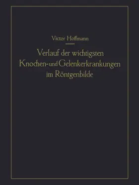 Hoffmann |  Verlauf der wichtigsten Knochen- und Gelenkerkrankungen im Röntgenbilde | Buch |  Sack Fachmedien