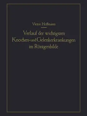 Hoffmann |  Verlauf der wichtigsten Knochen- und Gelenkerkrankungen im Röntgenbilde | eBook | Sack Fachmedien