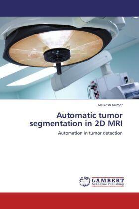 Kumar |  Automatic tumor segmentation in 2D MRI | Buch |  Sack Fachmedien
