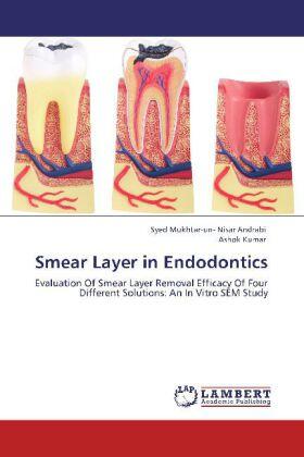 Andrabi / Kumar |  Smear Layer in Endodontics | Buch |  Sack Fachmedien