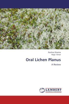 Sharma / Sircar |  Oral Lichen Planus | Buch |  Sack Fachmedien