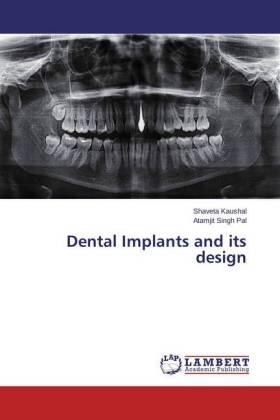 Kaushal / Pal |  Dental Implants and its design | Buch |  Sack Fachmedien