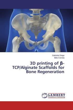 Diogo / Correia |  3D printing of ¿-TCP/Alginate Scaffolds for Bone Regeneration | Buch |  Sack Fachmedien