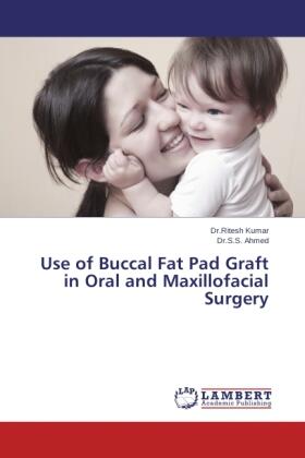 Kumar / Ahmed |  Use of Buccal Fat Pad Graft in Oral and Maxillofacial Surgery | Buch |  Sack Fachmedien