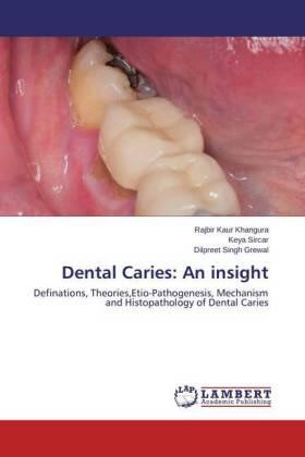 Khangura / Sircar / Grewal |  Dental Caries: An insight | Buch |  Sack Fachmedien