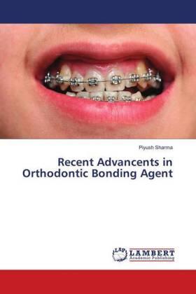 Sharma |  Recent Advancents in Orthodontic Bonding Agent | Buch |  Sack Fachmedien