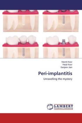 Kaur / Jain |  Peri-implantitis | Buch |  Sack Fachmedien