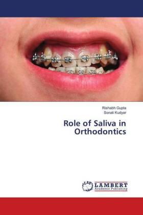 Gupta / Kudyar |  Role of Saliva in Orthodontics | Buch |  Sack Fachmedien
