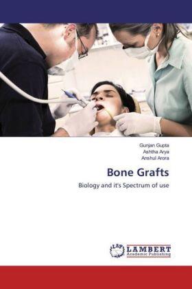Gupta / Arya / Arora |  Bone Grafts | Buch |  Sack Fachmedien